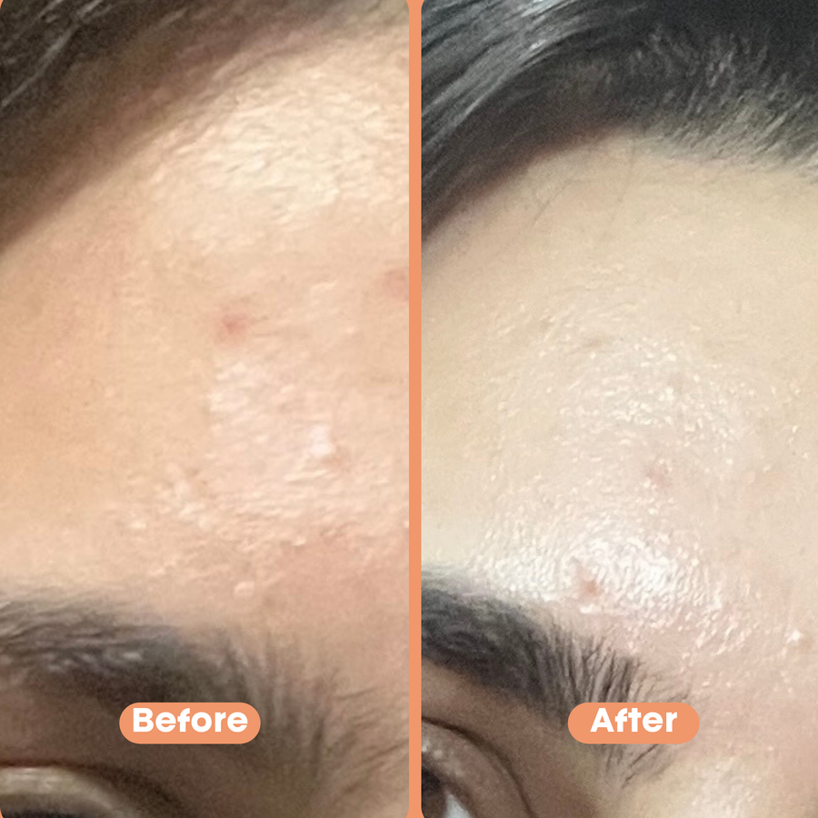 Peach Peptide Mousse