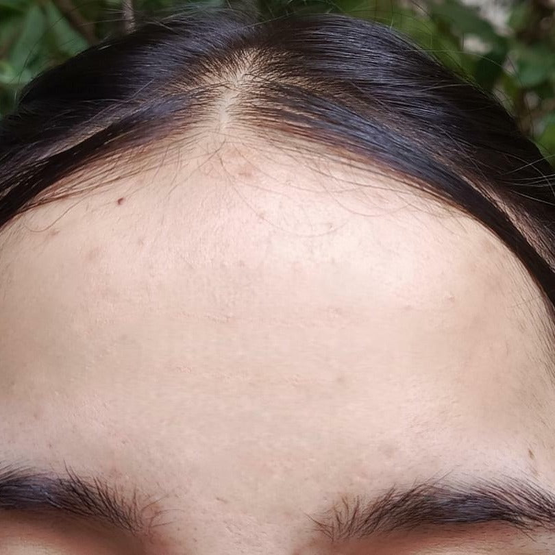 After using Promise