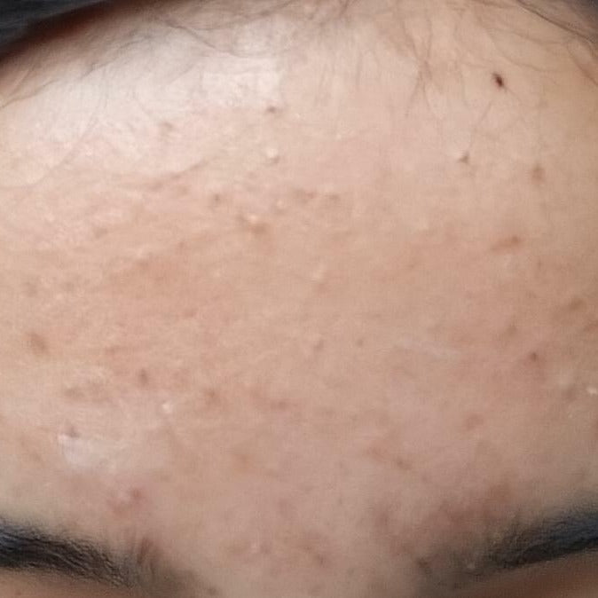 Before using Promise