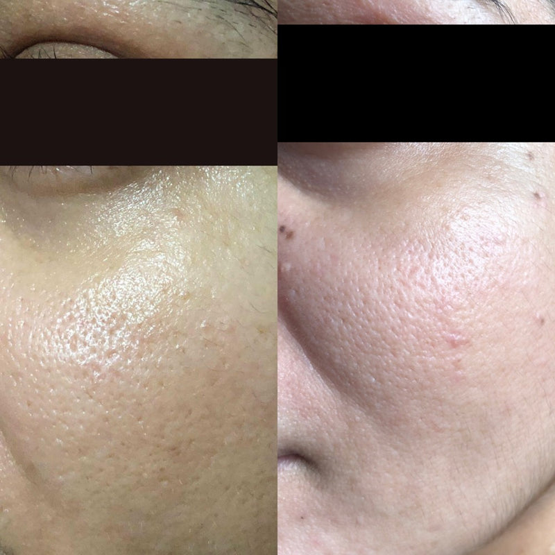 Peach Peptide Mousse
