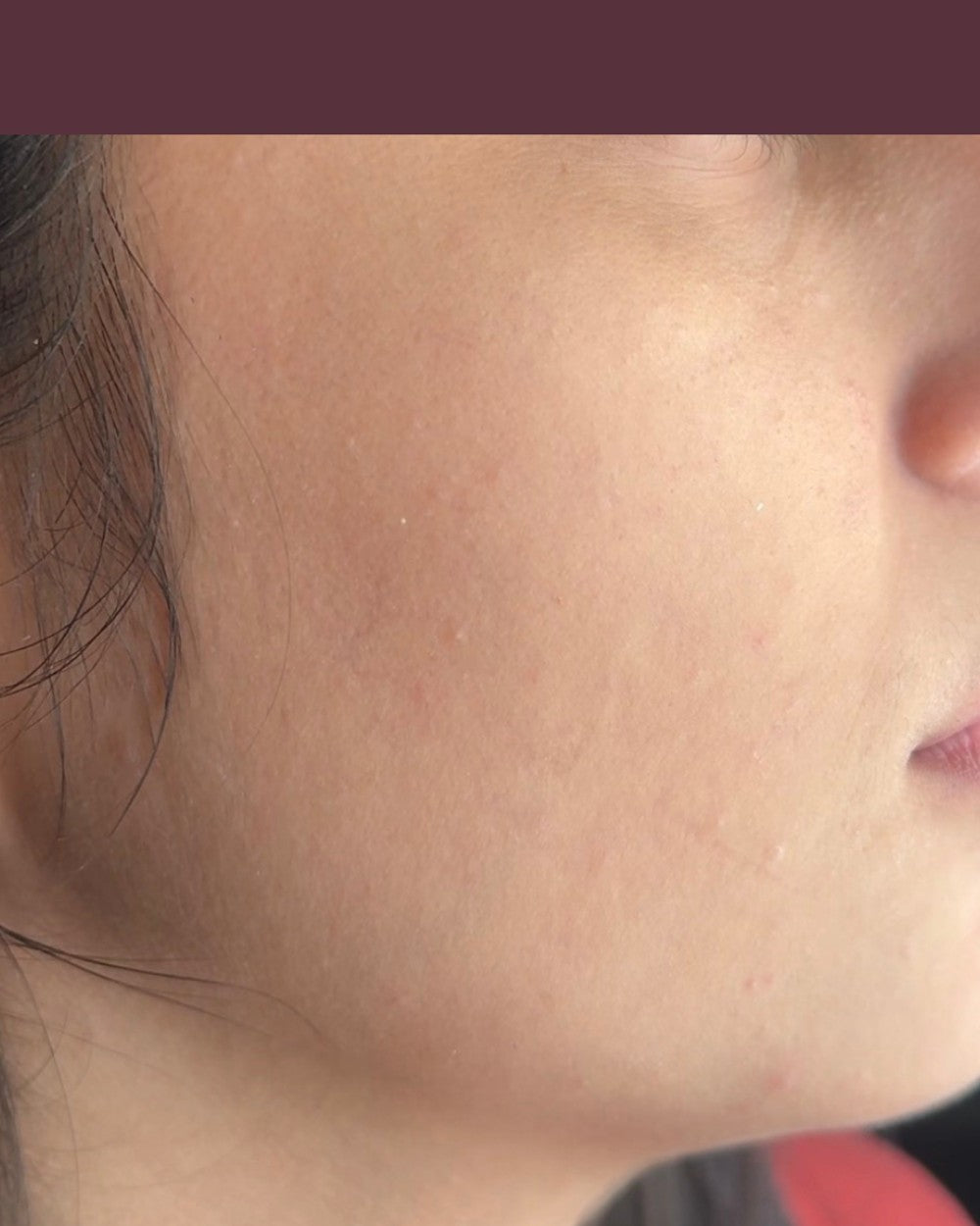 After using Watermelon Amino Brightening Face Wash
